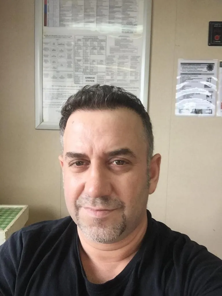 FUE — Sonrası