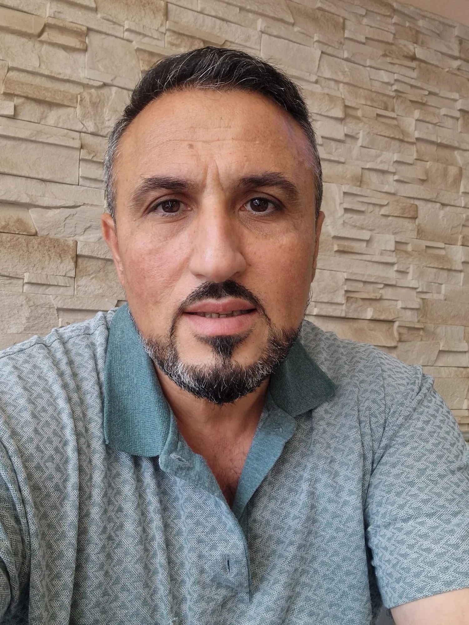 Safir FUE — Sonrası