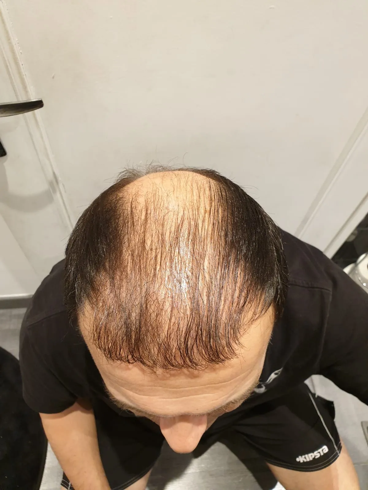 DHI — Öncesi