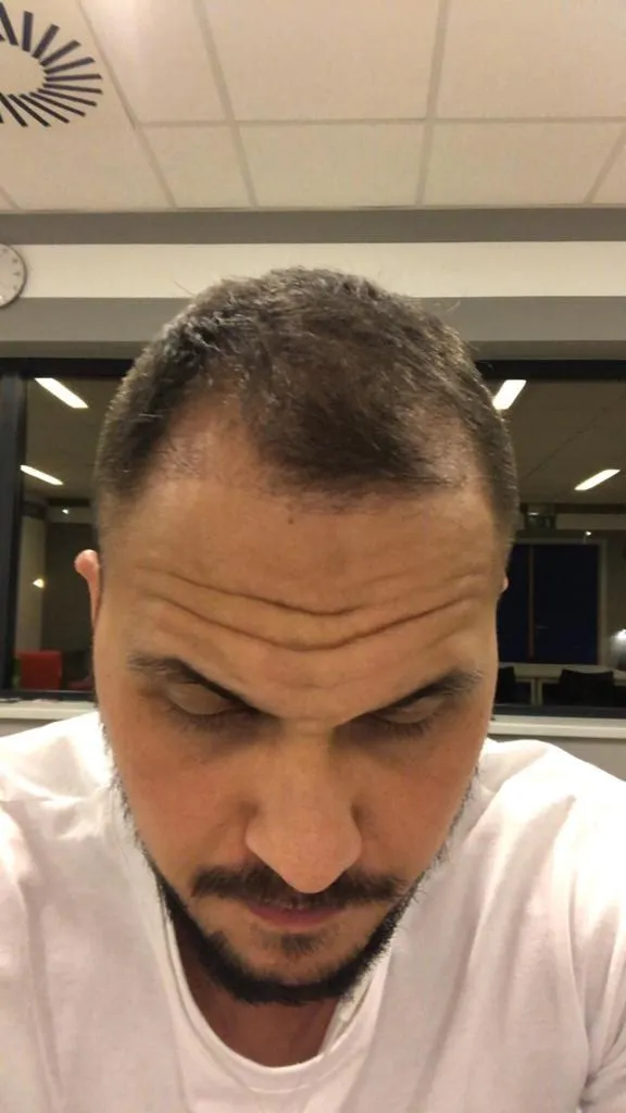 Safir FUE — Öncesi