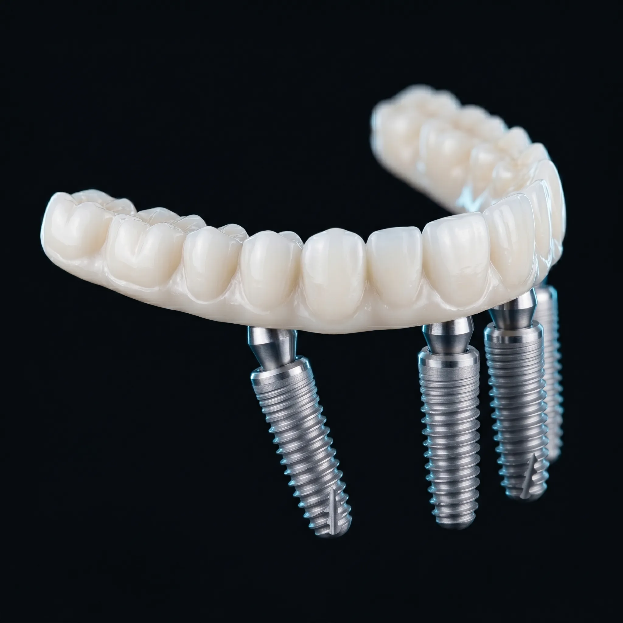 Implants All-on-4 en Turquie | Alpha Clinic